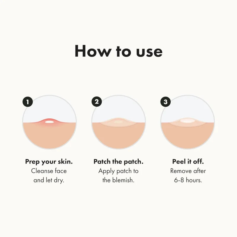 Mighty Patch Pimple Fix